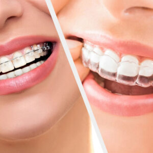 orthodontic treatments (braces & invisalign)